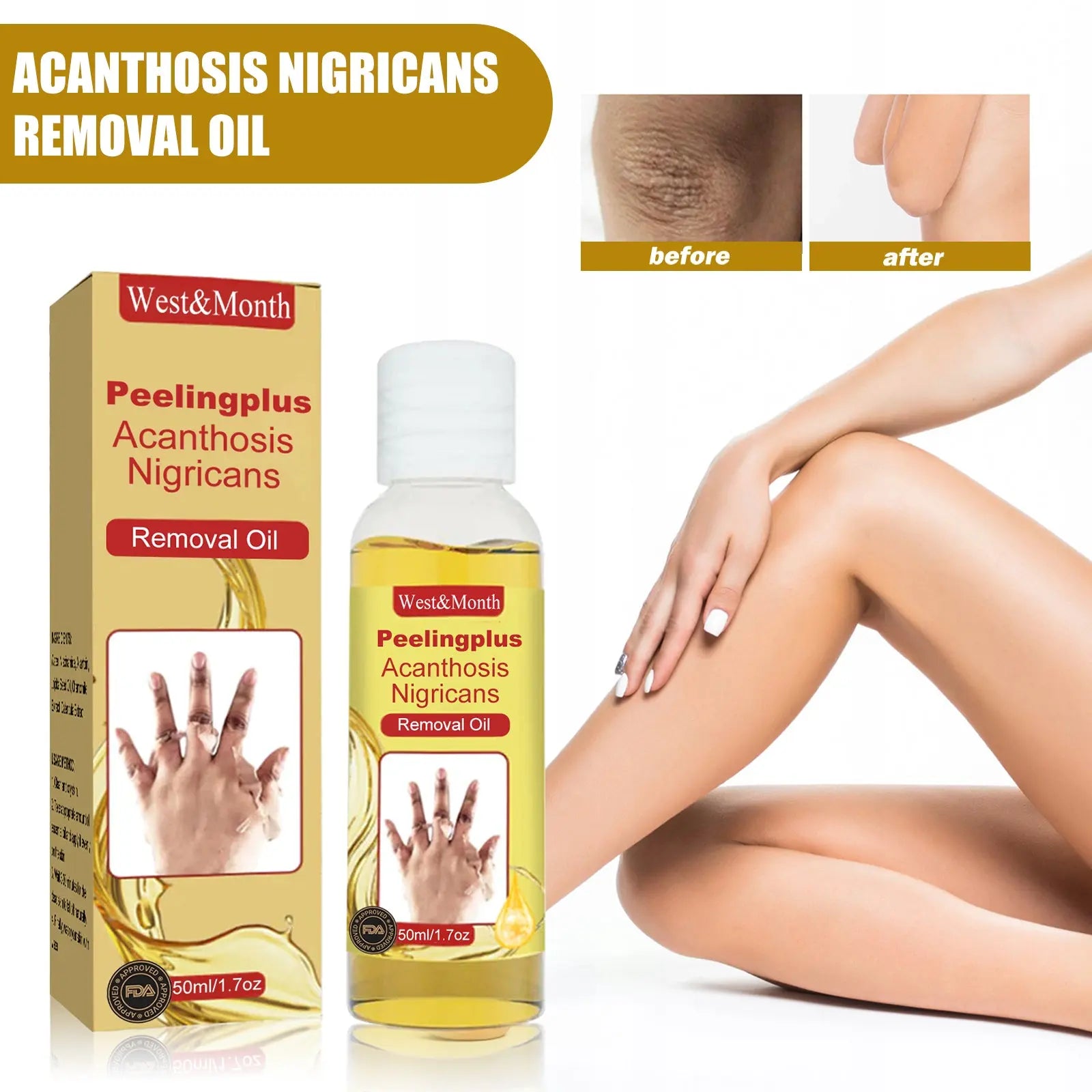 Acanthosis Nigricans Removal Oil, Exfoliating Light Black Brightening And Beauty Skin Oil eprolo