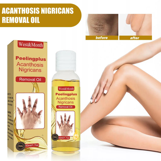 Acanthosis Nigricans Removal Oil, Exfoliating Light Black Brightening And Beauty Skin Oil eprolo