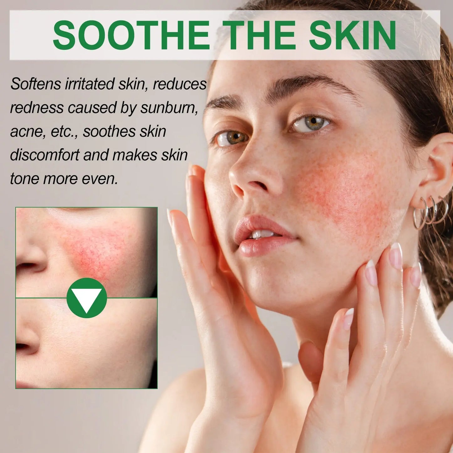 Color Correction Treatment Cream, Lighten Spots After Sun Repair Moisturizing Skin Beauty Cream eprolo