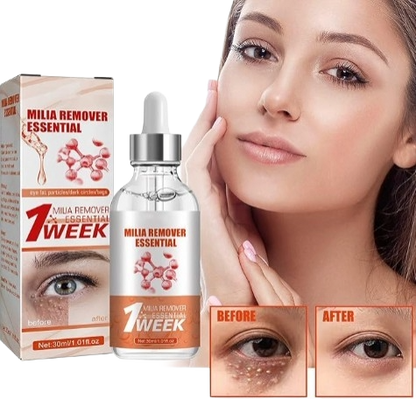 Smooth Milia Remover Serum