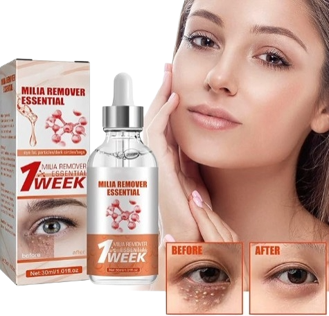 Smooth Milia Remover Serum